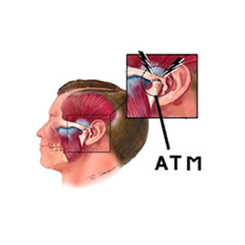 Dor na mandíbula? Cuidado! Pode ser DTM - Dr. Santo André