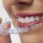 Invisalign: O que é, como funciona e o  preço?