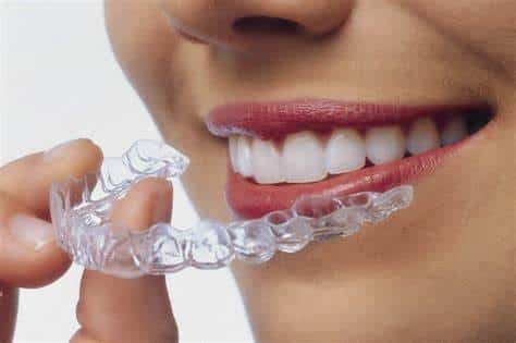 INVISALIGN  Dental Fine - Dentistas e Especialistas - Santo André